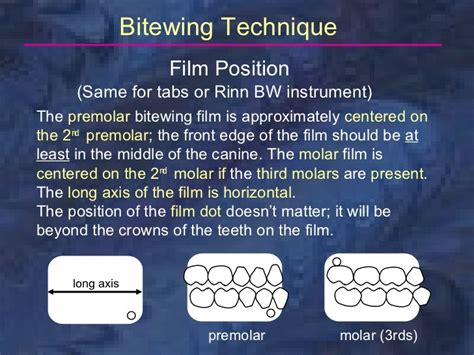 radiology-bitewing-technique