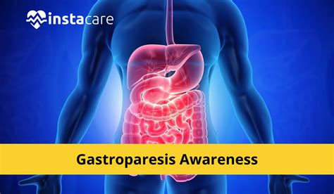 Gastroparesis: Symptoms, Causes, Complications and Diagnosis