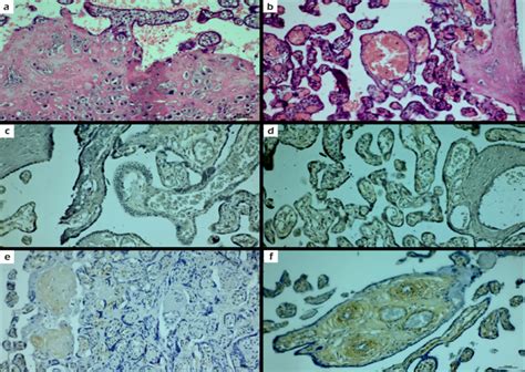 a, In the maternal placental part of the control group, decidua cells... | Download Scientific ...