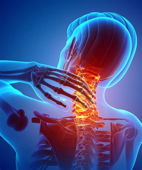 Is it safe to crack your neck? - Thorne Road Chiropractor