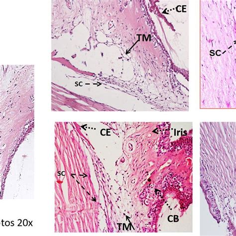 Rabbit trabecular meshwork after trabecular laser and human cord blood... | Download Scientific ...