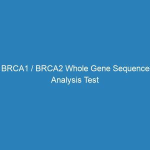 Beta 2 Microglobulin Test investigation (FREE Home/Office Sample ...