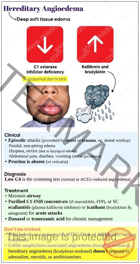 Hereditary angioedema - Medicine Keys for MRCPs