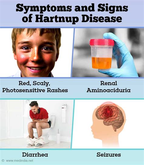 Hartnup Disease - Causes, Symptoms, Diagnosis, Treatment and Prevention