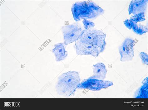 Human Cheek Epithelial Image & Photo (Free Trial) | Bigstock