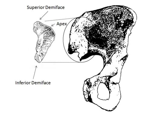 Image of where the auricular surface is located on the pelvis, as... | Download Scientific Diagram