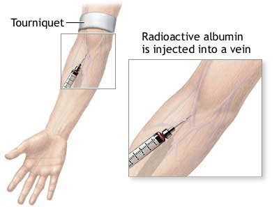 mynsgnotes.blogspot.com: Intravenous Injection (IV INJECTION)