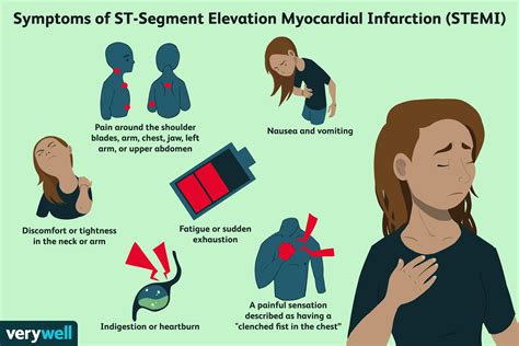 St Elevation Myocardial Infarction