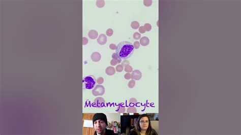 Metamyelocyte Morphological Characteristics - YouTube