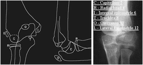 Minor injuries part 2 - Paediatric Pearls