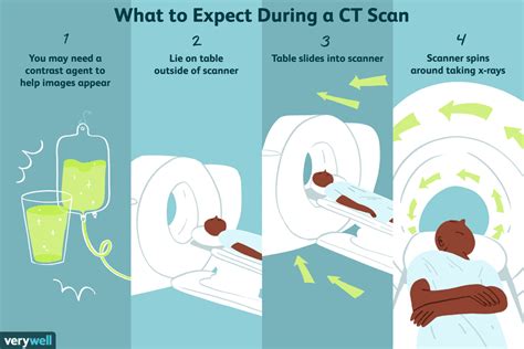 CT Scan: Uses, Side Effects, Procedure, Results