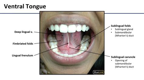 Anatomy Of Underside Of Tongue