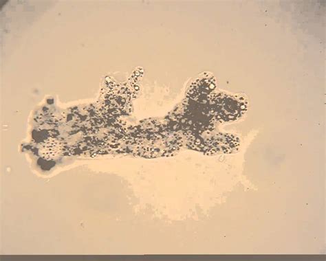 Live Amoeba proteus showing amoeboid movement - YouTube