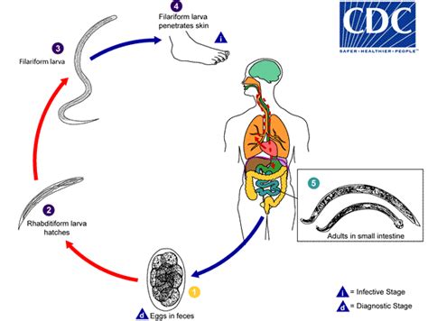 Hookworm infection pathophysiology - wikidoc