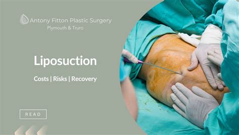 Liposuction Costs | Risks | Recovery | Antony Fitton Plastic Surgery