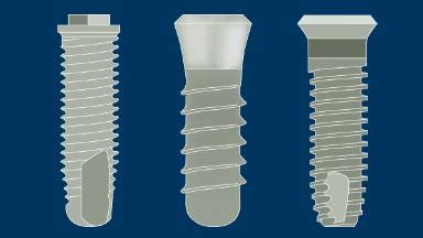 Selecting an Implant System - Assessments - Home - ITI