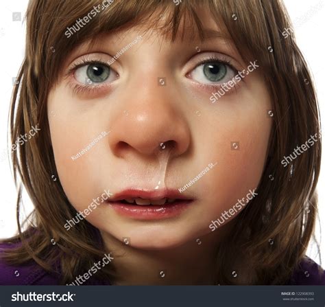 Runny Nose Cold Ill Little Girl Stock Photo 122908393 | Shutterstock