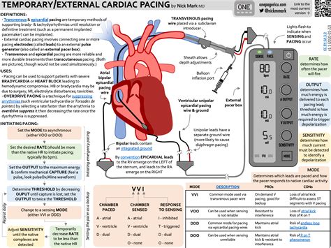 Temporary epicardial pacing and sensitivity - INTENSIVE