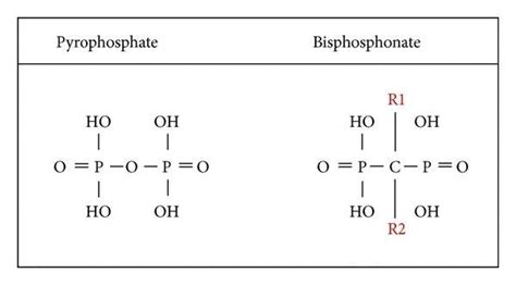 Chemical structure of pyrophosphate and bisphosphonate. R1 and R2 ...