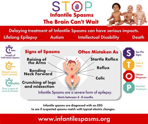 Dec. 1-7 is Infantile Spasms Awareness Week - Child Neurology Foundation