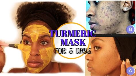 Turmeric Face Mask Before And After Pictures