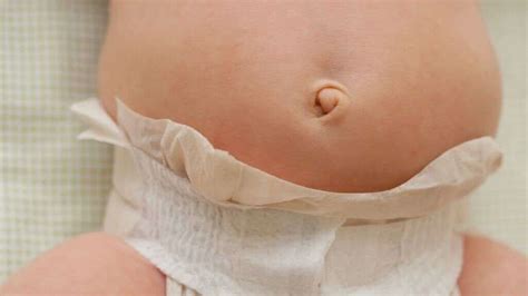 Belly Button Infection: What Is a Belly Button Infection?