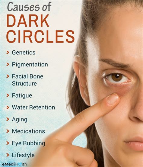 Possible Causes of Dark Circles and Treatment Options