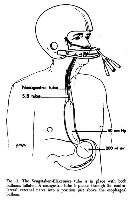 Sengstaken-Blakemore, Minnesotta and Linton-Nachlas tubes | Deranged Physiology