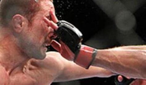 MMA Fighter's Career Ruined By Eye Poke - ENT Imports