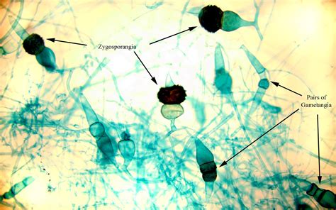 ‎Zygosporangia of Rhizopus - UWDC - UW-Madison Libraries