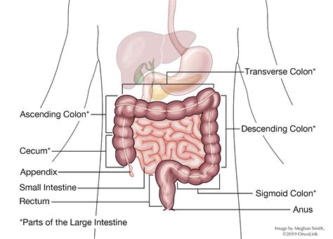 Surgical Procedures: Colectomy | OncoLink