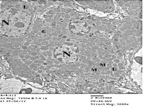 An electron micrograph of zona fasciculata cells from group III showing... | Download Scientific ...