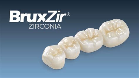 How to Choose Between Zirconia Crowns and IPS e.max® Crowns | Glidewell