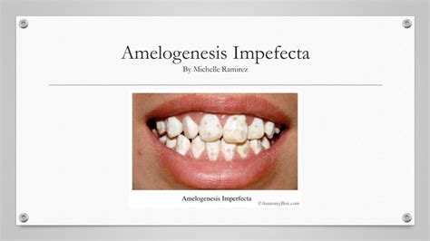 Histology-Amelogenesis Imperfecta – Michelle Ramirez’s ePortfolio