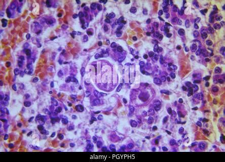 Electron microscope image of cytomegalovirus Stock Photo - Alamy