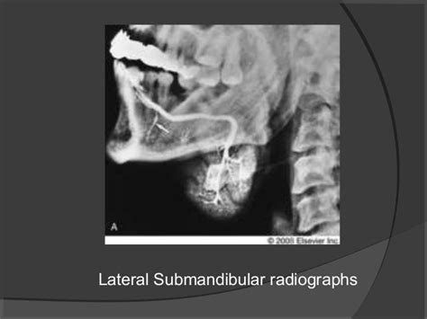 Sialography & dacrocystography