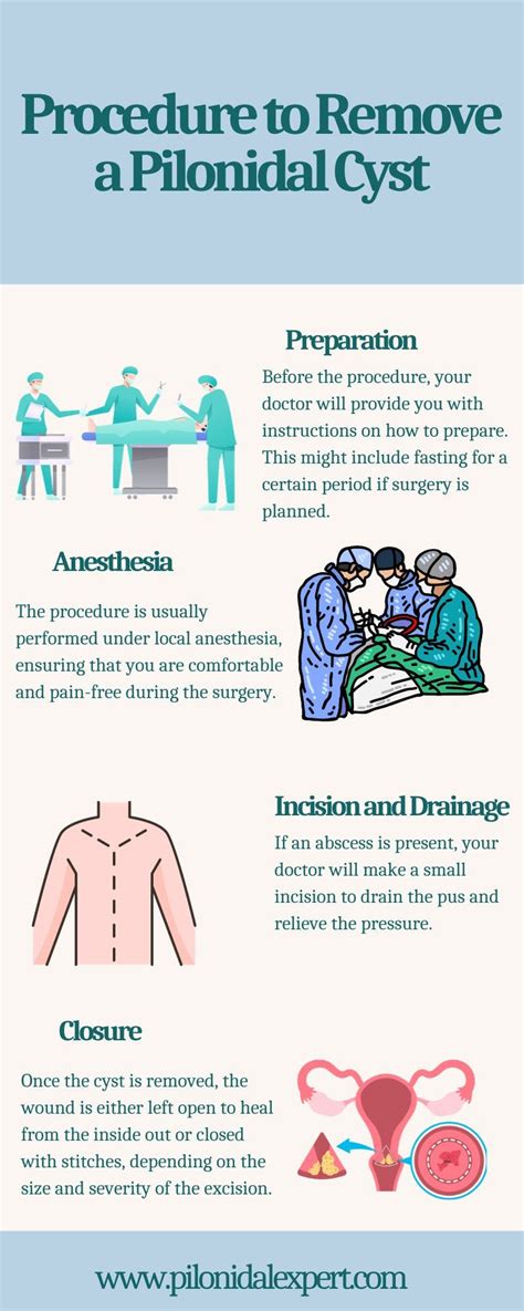 What Is The Procedure To Remove A Pilonidal Cyst Infection? - DaniellaLloyd - Medium