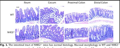 Figure 1 from Acidic Conditions in the NHE2-/- Mouse Intestine Result ...