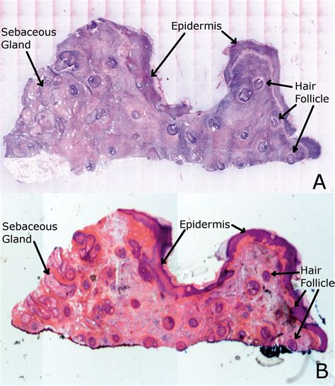 Human Skin Cell Labeled