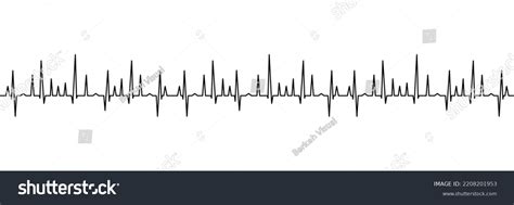 Heart Beat Diagram Illustration Vector Illustration Stock Vector (Royalty Free) 2208201953 ...