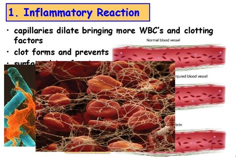 Tissue Repair Tissue Repair Wound healing Two ways