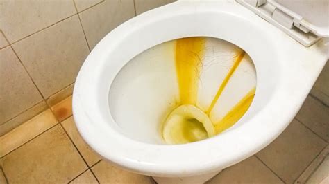 Remove Water Stains In Toilet