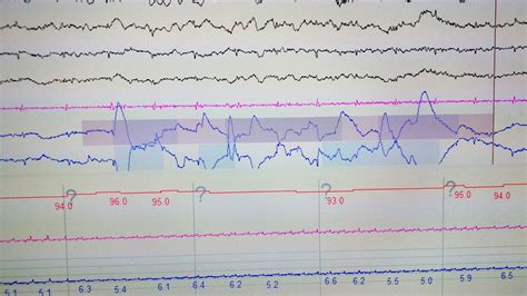 Can white noise help you sleep better? | Live Science