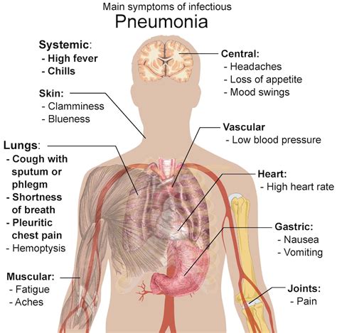 World Pneumonia Day Focuses on Awareness, Prevention > Walter Reed ...