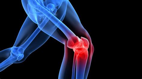 5 Simple Knee Injury Prevention Exercises - stack