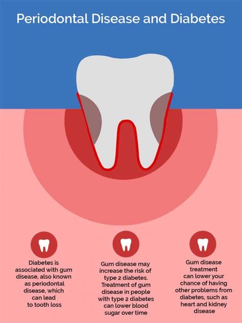 The Mouth-Body Connection - Periodontist in Birmingham, AL - Gum Disease Treatment