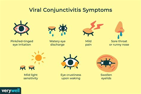 Viral Conjunctivitis: Overview and More