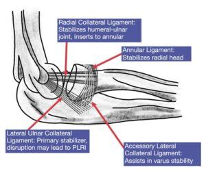 Elbow LCL Treatment | Hand Therapy Academy