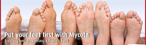 Mycota Powder 70g, Treats and Prevents Athlete's Foot, Relieves Itching and Irritation : Amazon ...