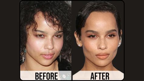 Did Zoe Kravitz Get Plastic Surgery? Zoe Kravitz Before and After Plastic Surgery and More - News